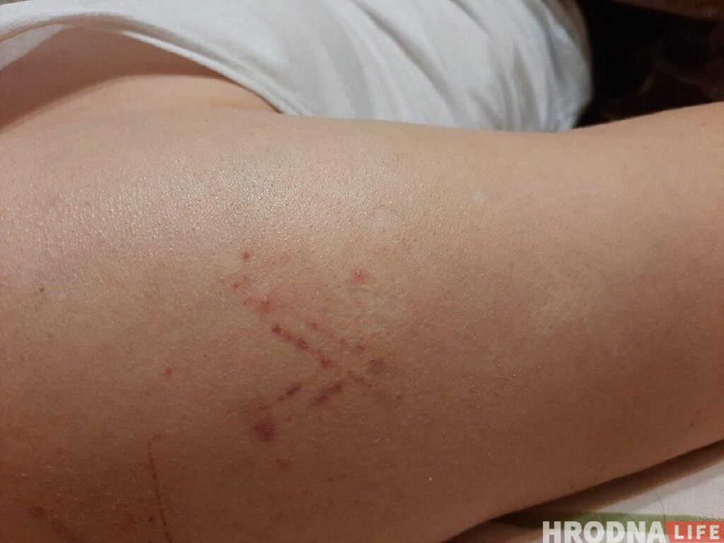 Гродненец во время протестов попал в аварию с участием автозака. Ему грозит до двух лет лишения прав за аварийную ситуацию