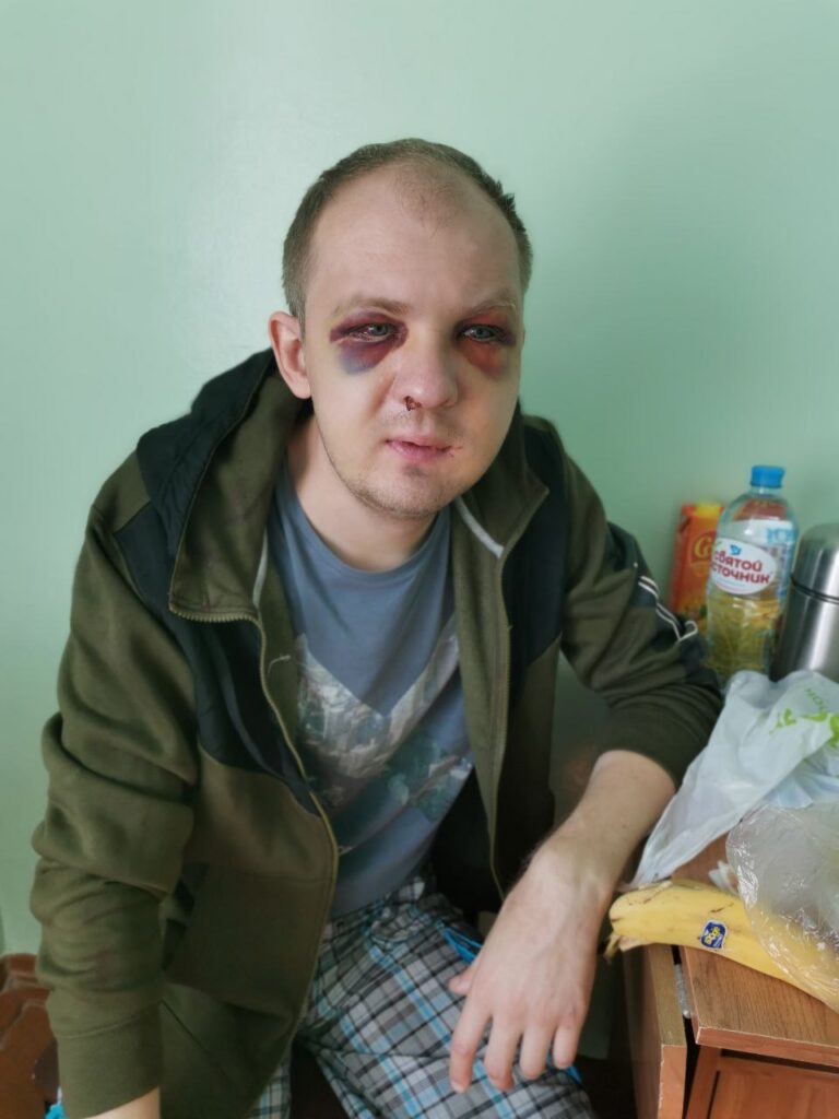В Гродно начали судить таксиста, которого избил ОМОН. Пострадавших двое, у одного - несколько синяков