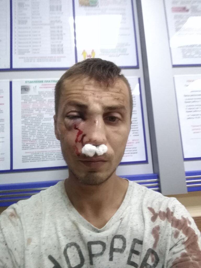 «Мы любога заб'ем, але вам горад не аддадзім». Пра што распавялі гродзенцы, якія прыйшлі здымаць пабоі ў судмедэкспертызу