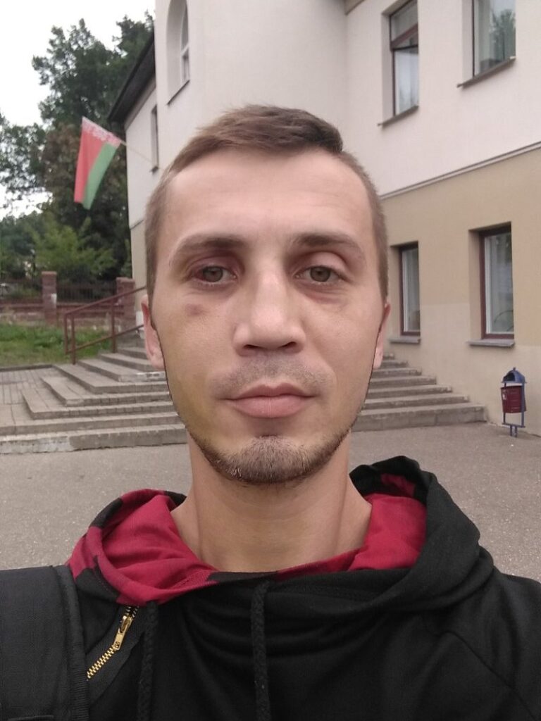 «Мы любога заб'ем, але вам горад не аддадзім». Пра што распавялі гродзенцы, якія прыйшлі здымаць пабоі ў судмедэкспертызу