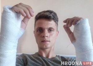 У журналиста Hrodna.Life Руслана Кулевич переломы обеих рук